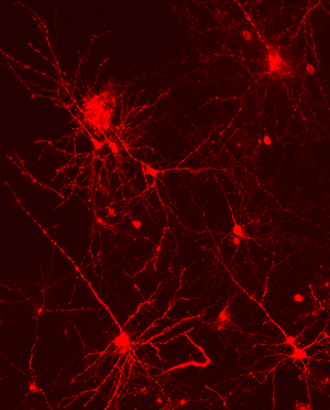 Dye-labeled cortical neurons
