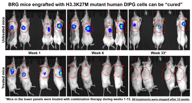 Mice implanted with fatal human tumors can be cured using a combination drug therapy.