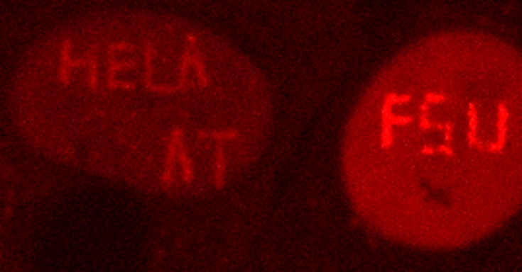 Recruitment of PCNA to the sites of laser microirradiation induced DNA damage in live human HeLa cells. 