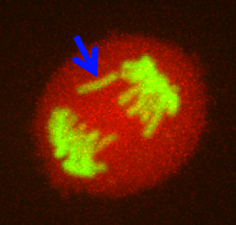 Lagging chromosome during anaphase in a cell. 
