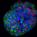 Fluorescent microscope image of human-derived pancreatic beta cell 