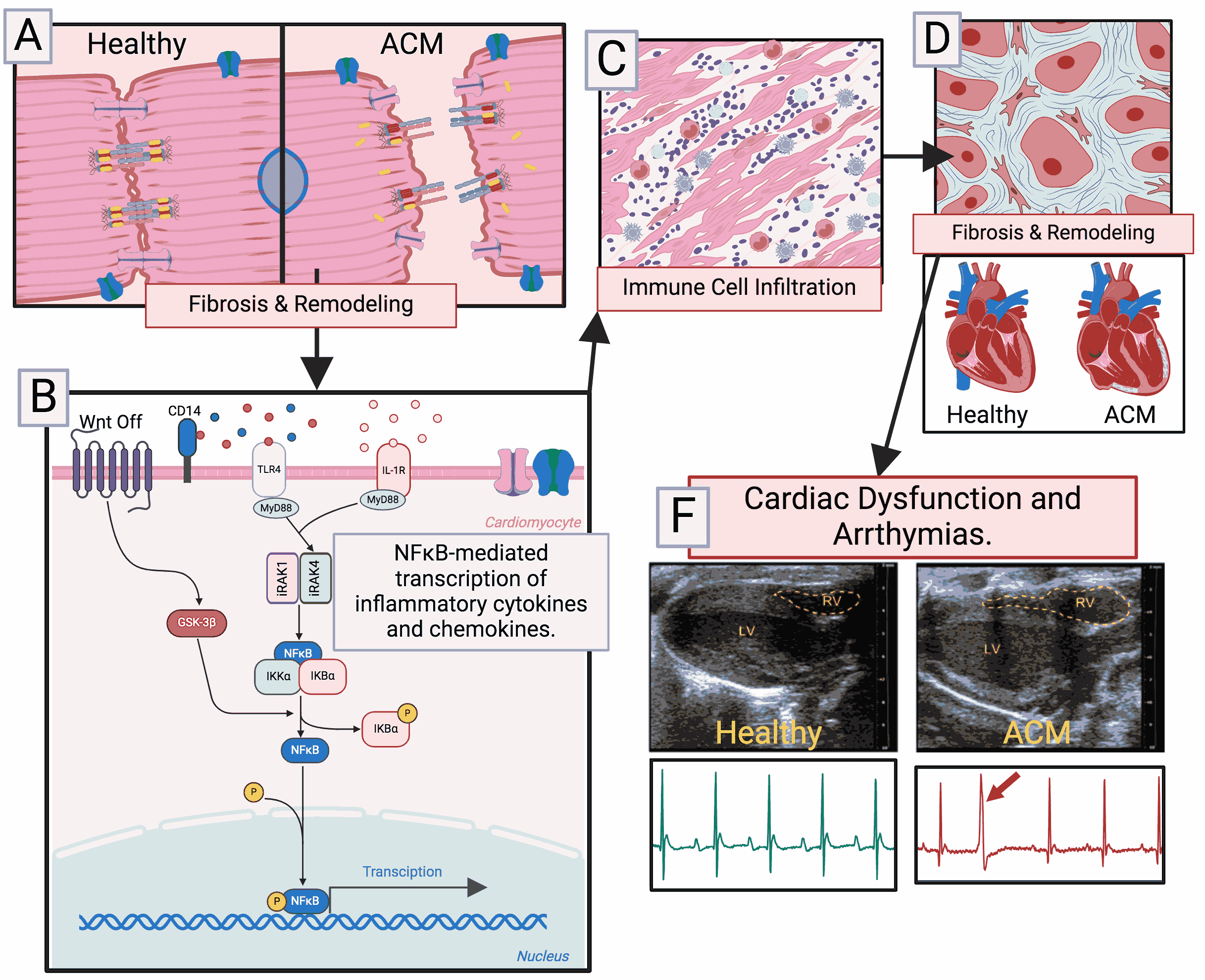 ACM Summary Figure