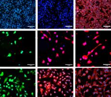 Astrocytes