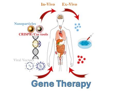 Gene therapy graphical abstract