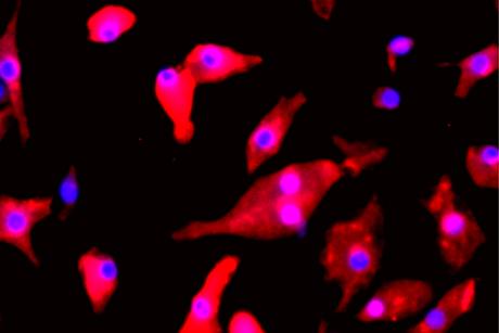New treatment for pediatric brain cancer