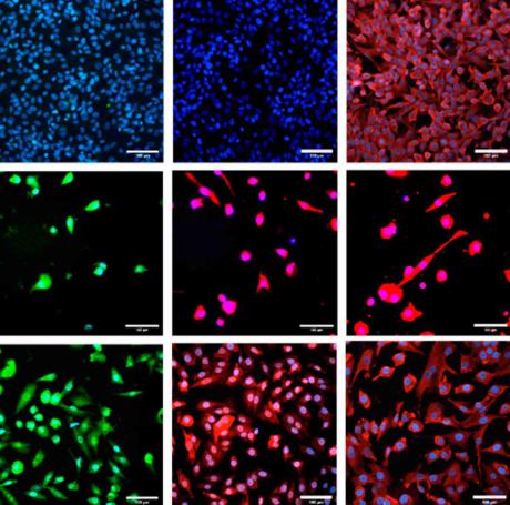 Astrocytes