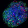 Fluorescent microscope image of human-derived pancreatic beta cell 